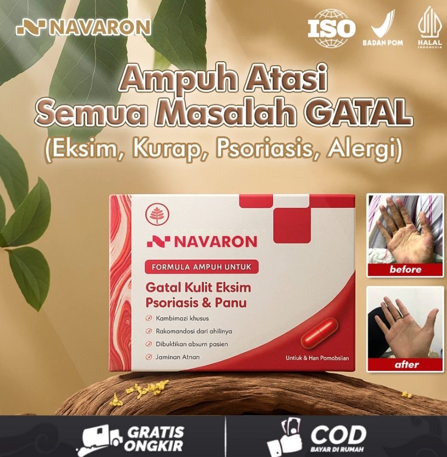 Navaron Formula Ampuh Untuk Obat Gatal