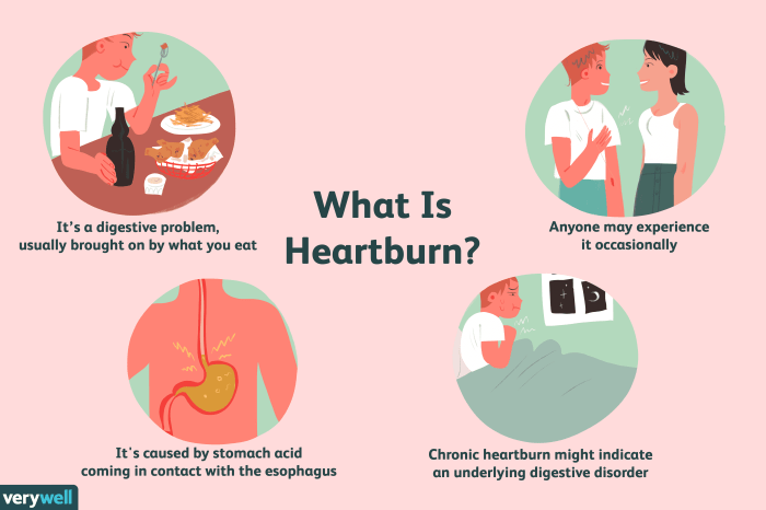 Acid Reflux Home Remedies That Provide Relief Acid Reflux Home Remedies That Provide Relief