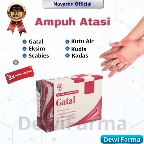 Navaron Herbal Obat Untuk Gatal